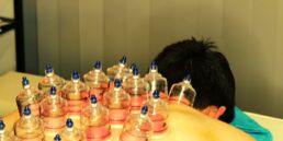 Cupping therapie en cups massage