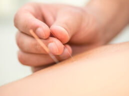 therapeutische massages - Chinese Dry Needling